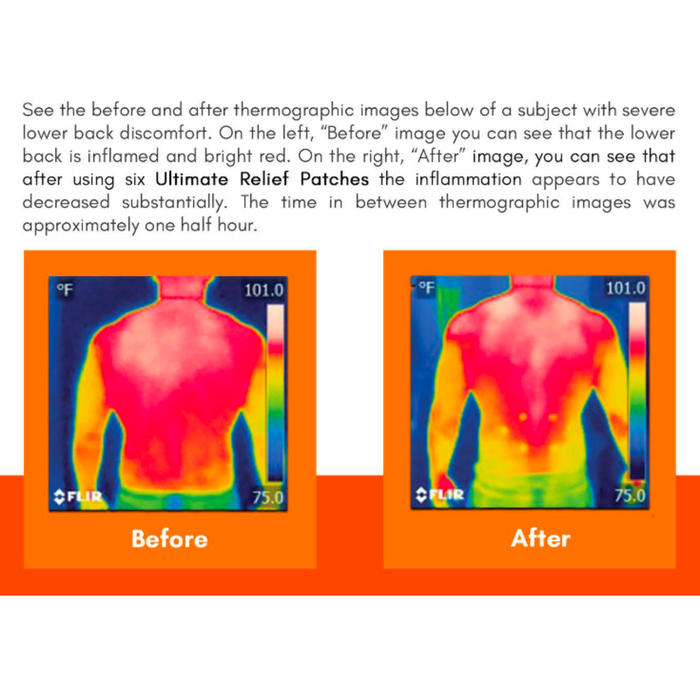 Therasage TheraVibe Ultimate Relief Patch package, view 4 of 4
